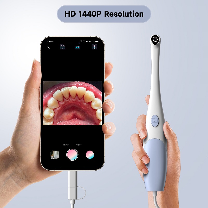 Oral Endoscope Camera 1440P Ph - Photography And Videography Lighting 评论和价格
