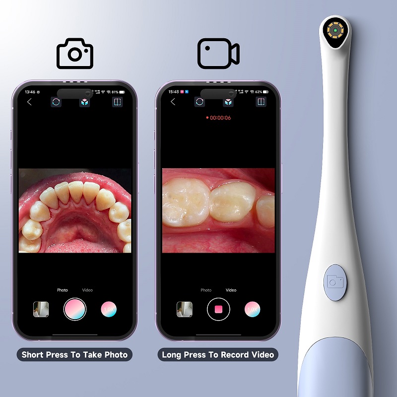 Oral Endoscope Camera 1440P Ph - Photography And Videography Lighting 评论和价格